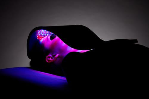 Hyperpigmentation with LED Red Light Therapy