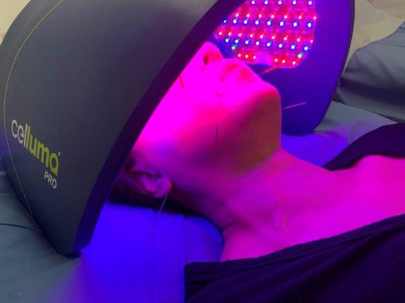 A Woman is Combining Light Therapy With Acupuncture